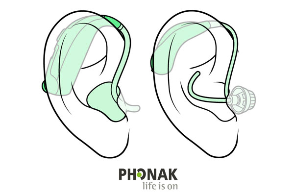 PhonakBTE